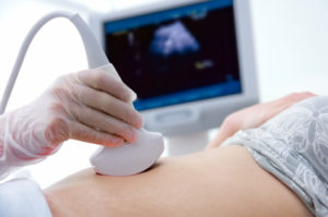 Doctor giving patient an ultrasound